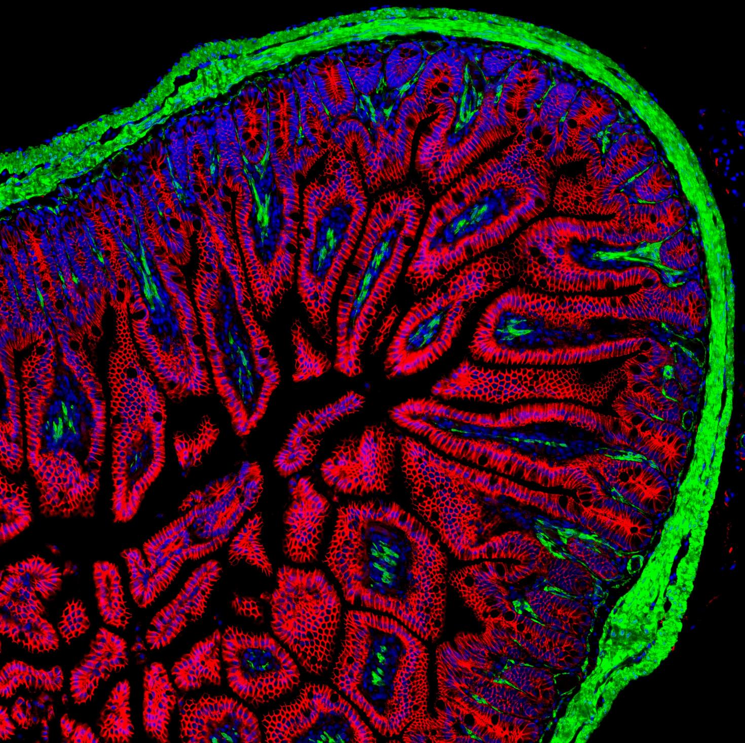 Image avec Microscopie confocale à balayage laser (MCBL)