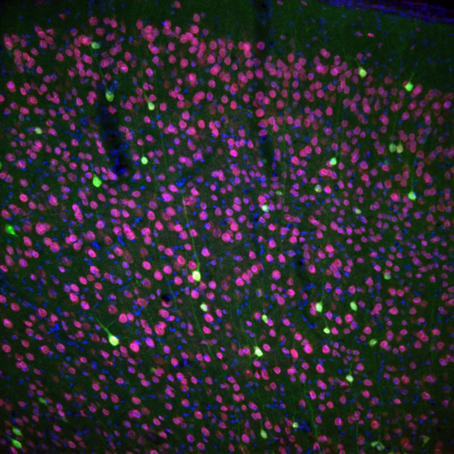 Image avec Microscopie à fluorescence par sectionnement optique
