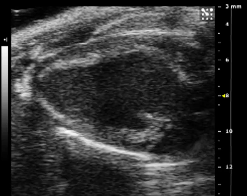 Echo long axis image acquired with vevo2100