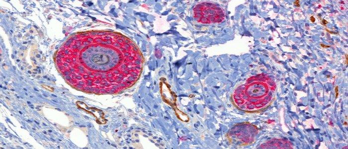 Double marqueur chromogène immunohistochimique dans la peau d’une souris