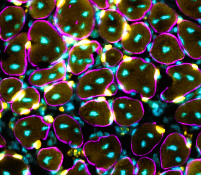 Satellite cells