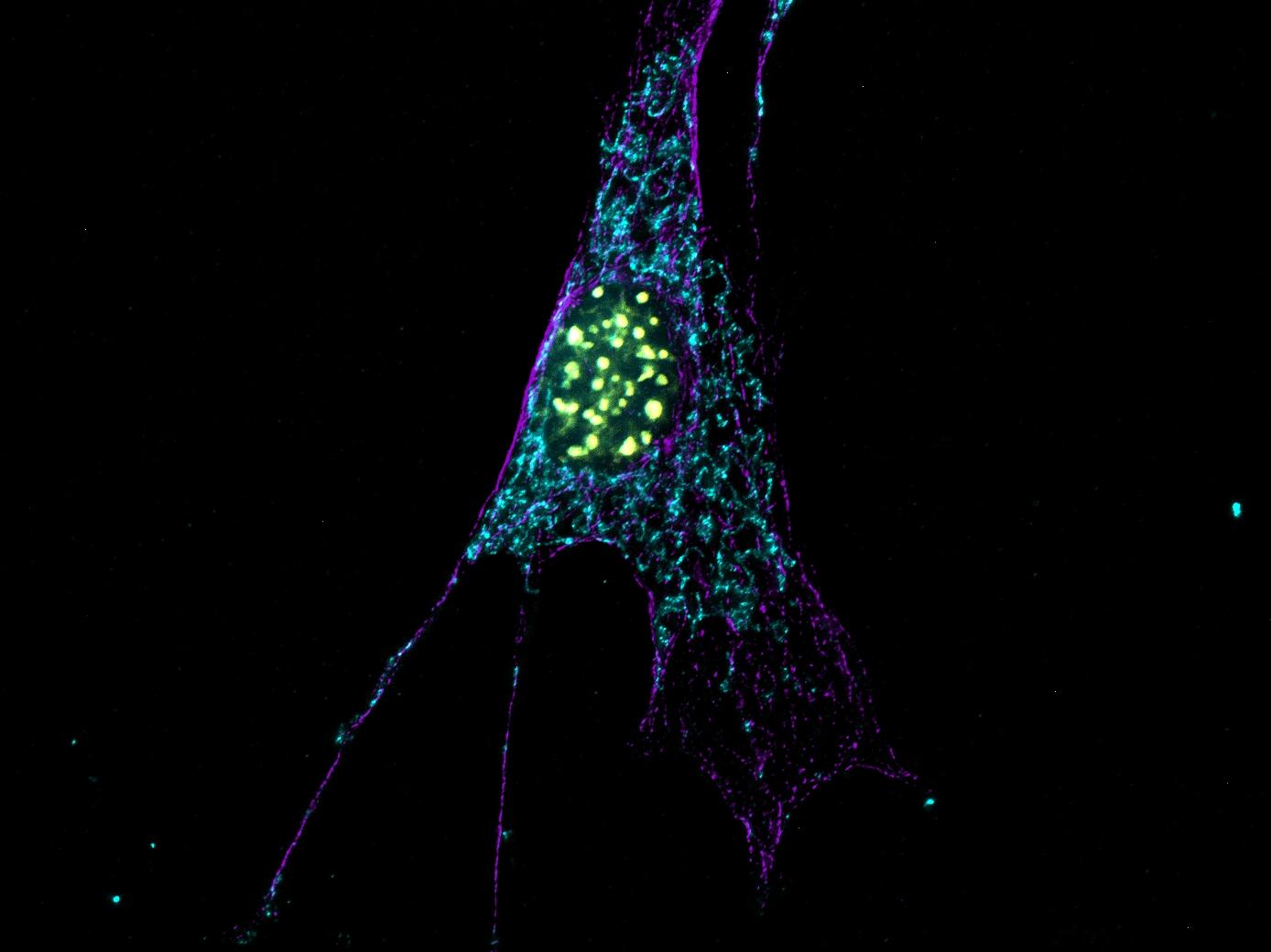 Deconvultion image