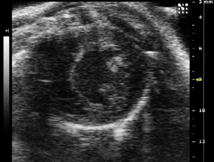 Echo short axis image acquired with vevo2100