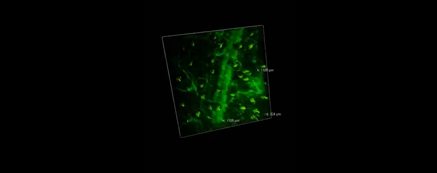 Intravital microscopy image