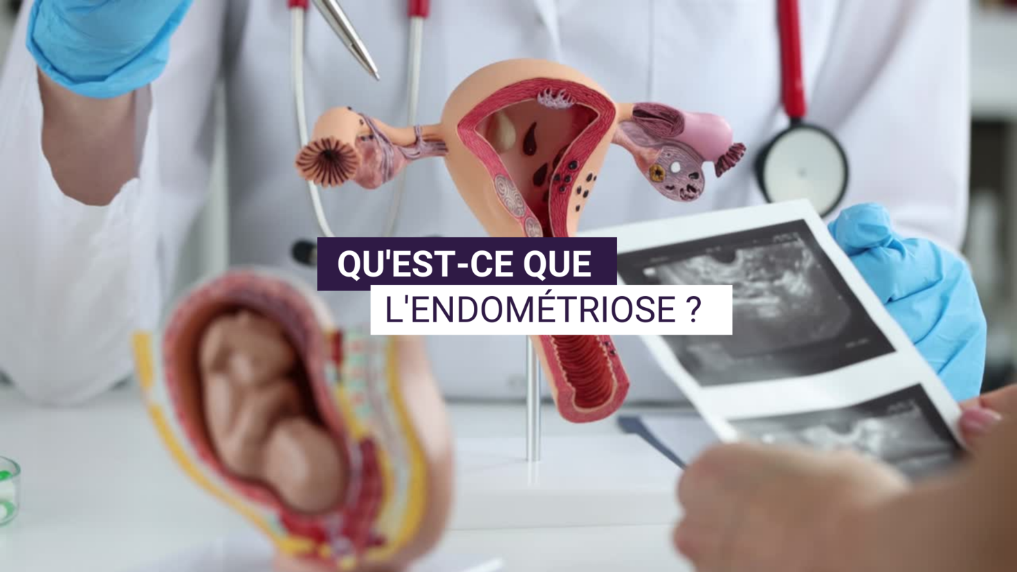 Clinicien avec un modèle d'utérus