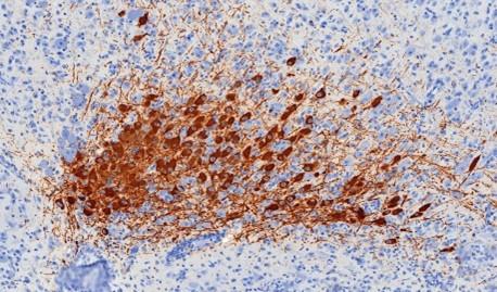 IHC Staining of dopaminergic neurons in the mouse brain