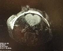 The love for MRI (A section of mouse brain)