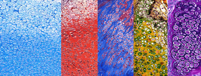 Différentes colorations spéciales sur chondrocytes