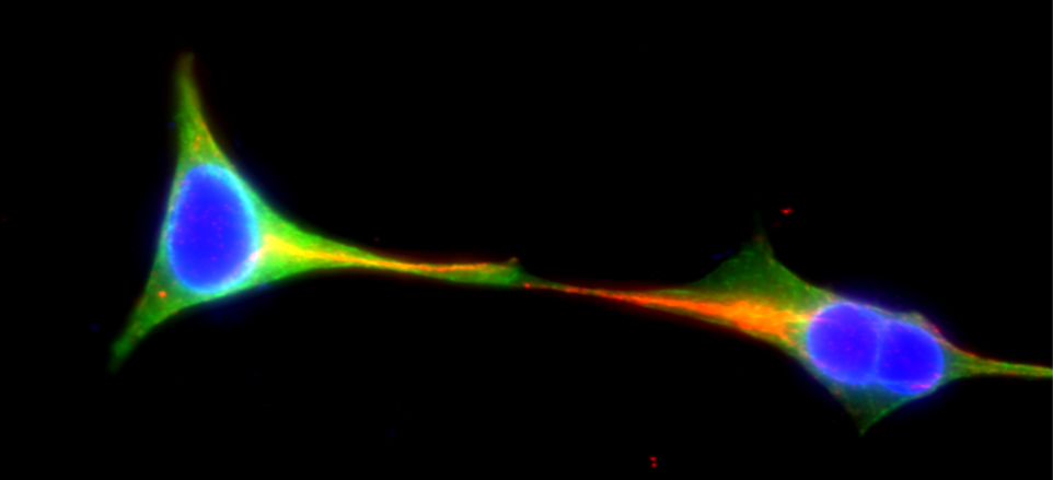 La communication de cellule à cellule : "Le premier baiser"