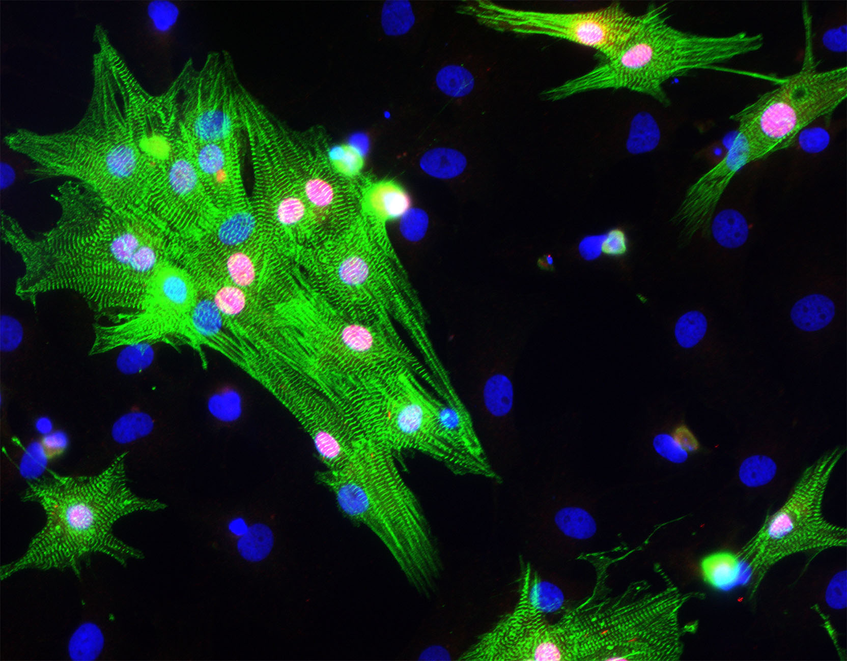 Des cardiomyocytes plus forts grâce à la protéine cardiaque PEX1