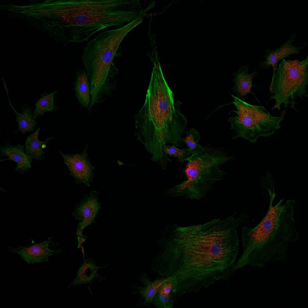 Image avec Illumination structurée