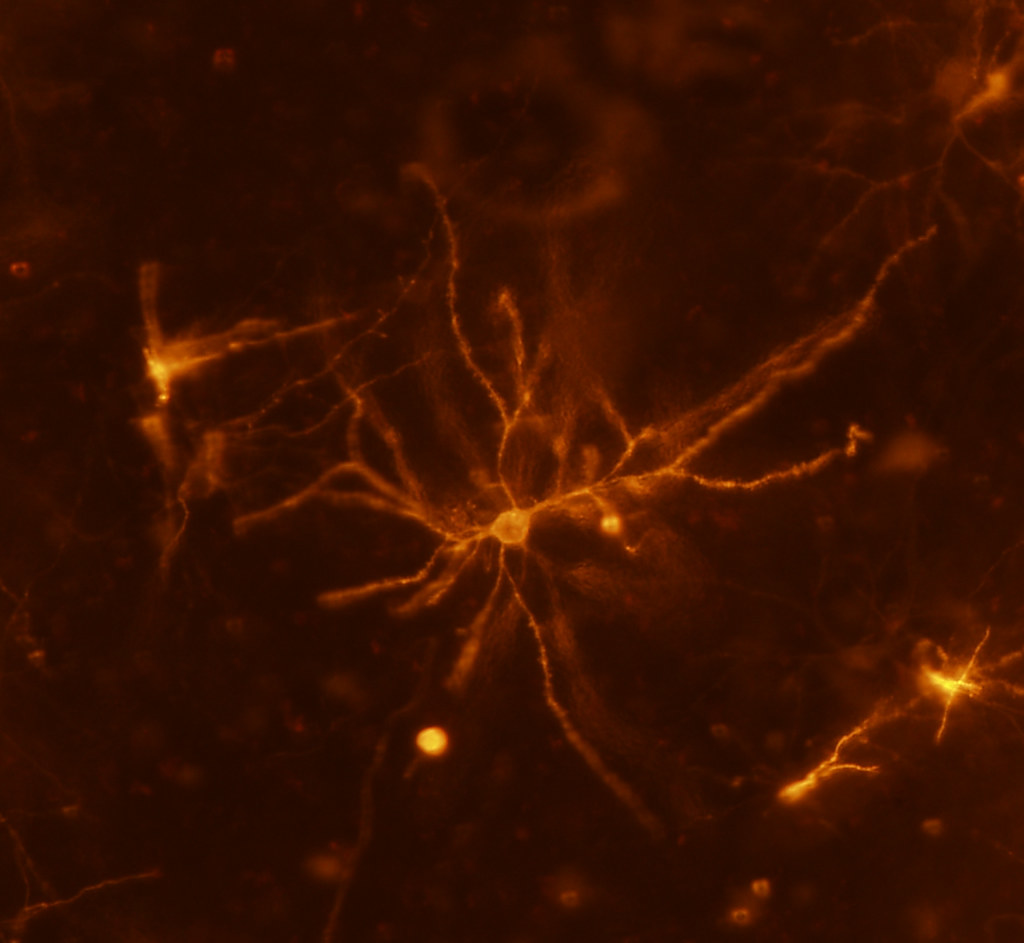 Image avec Microscopie confocale multiphotonique