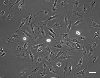Image microscopique avec la technique du contraste de phase