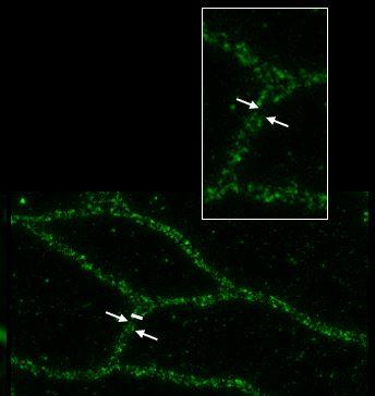 Image avec Microscopie à déplétion par émission stimulée (STED)
