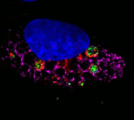 Image microscopique avec la microscopique à épifluorescence