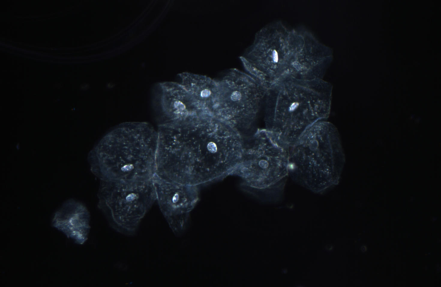 Image microscopique avec la technique de champ sombre
