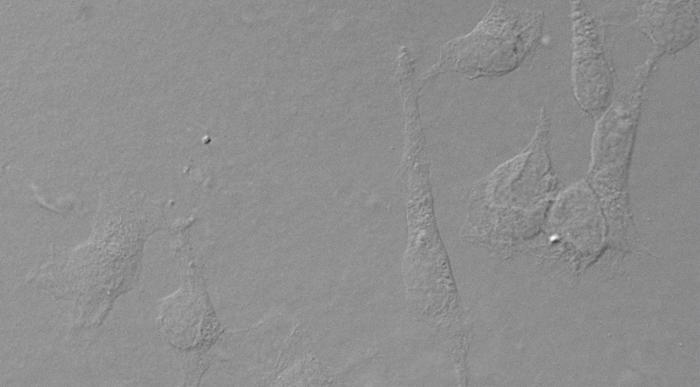 Image microscopique avec le Contraste interférentiel différentiel (CID)