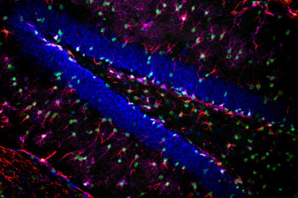 CBIA microscope image