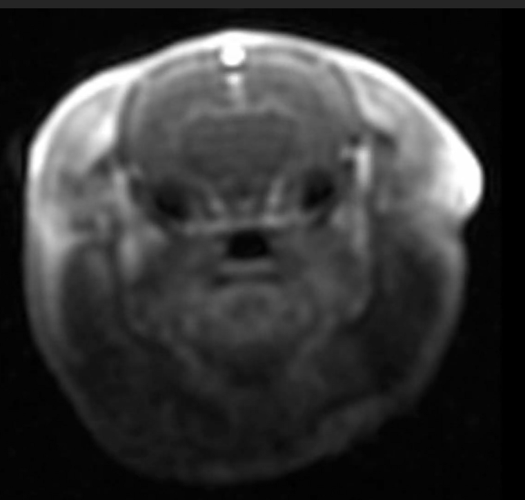 Image IRM d'une perfusion cérébrale