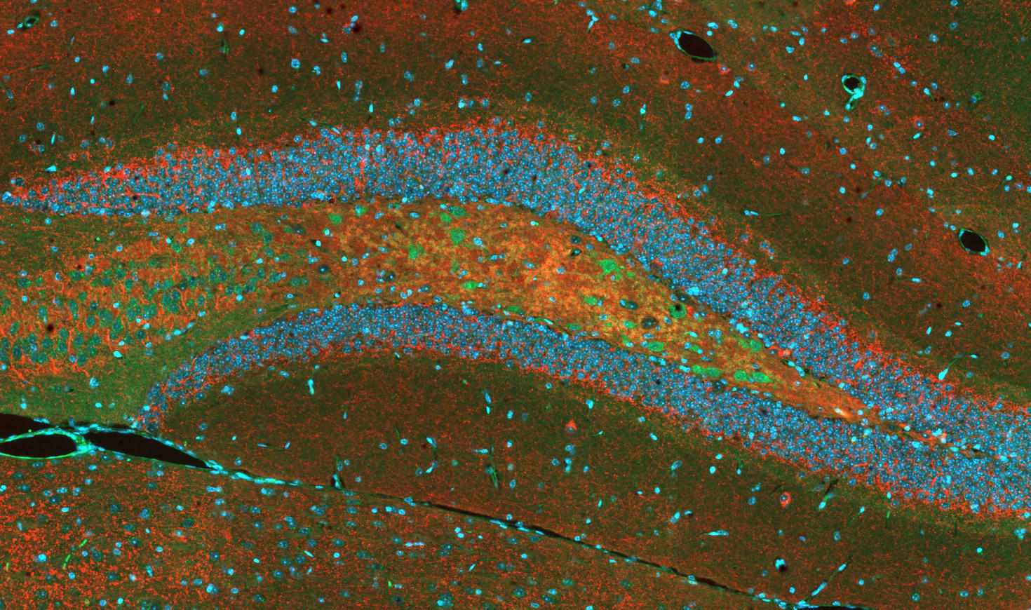 Double marqueur par immunofluorescence dans le cerveau d’une souris