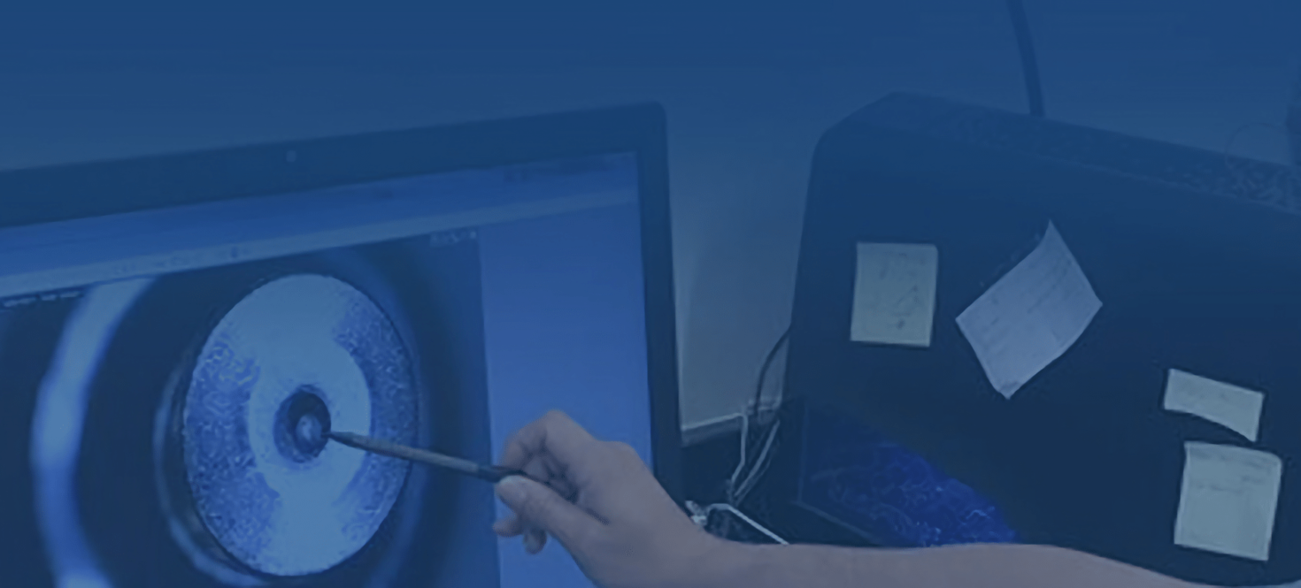 Une personne pointant un écran avec des résultats du laboratoire