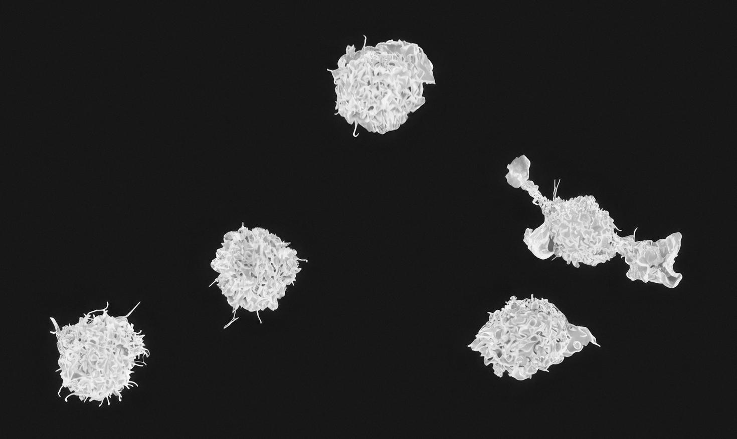 Macrophages Micrographie électronique colorisée de macrophages