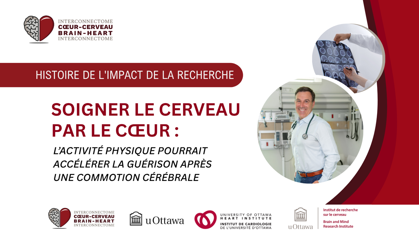Soigner le cerveau par le cœur : l’activité physique pourrait accélérer la guérison après une commotion cérébrale