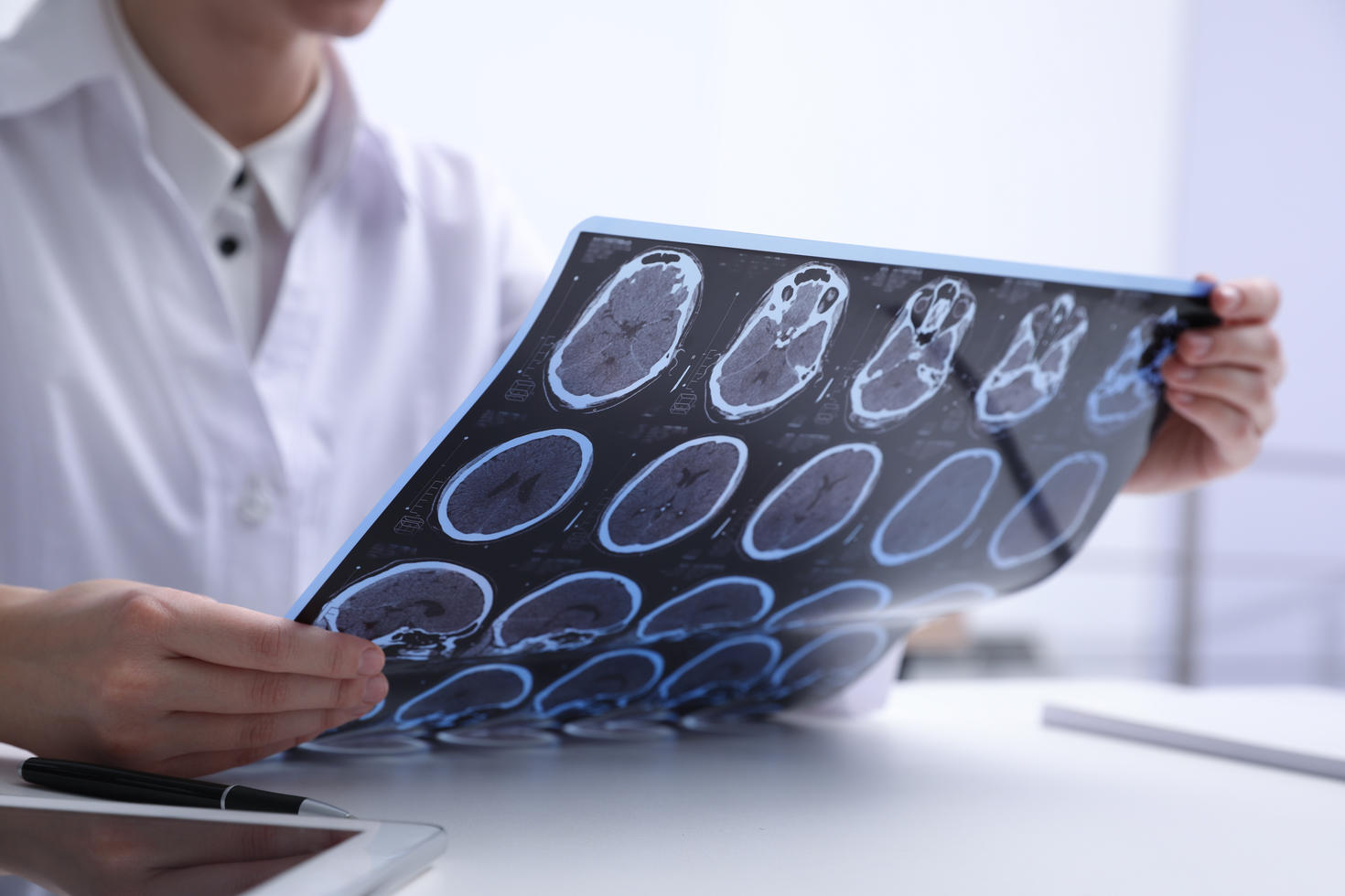 Médecin regardant un IRM du cerveau