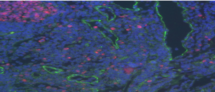 Double labelling by immunofluorescence in human tonsil