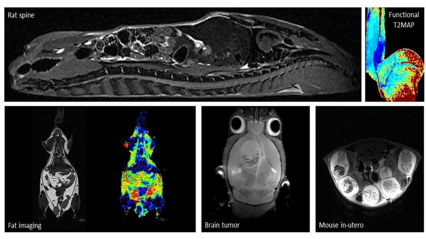 MRI images of rat spine, brain tumor, fat imaging and mouse in-utero