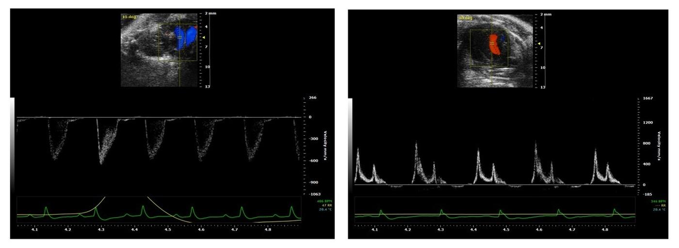 Examples of ultrasound images (blood flow analysis) acquired by our Vevo 2100