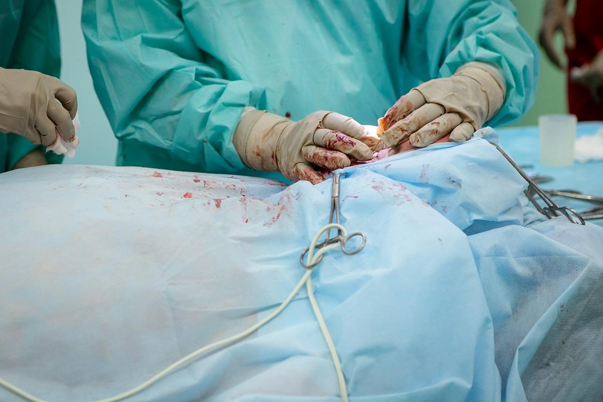 Surgeon operating with some blood splatter