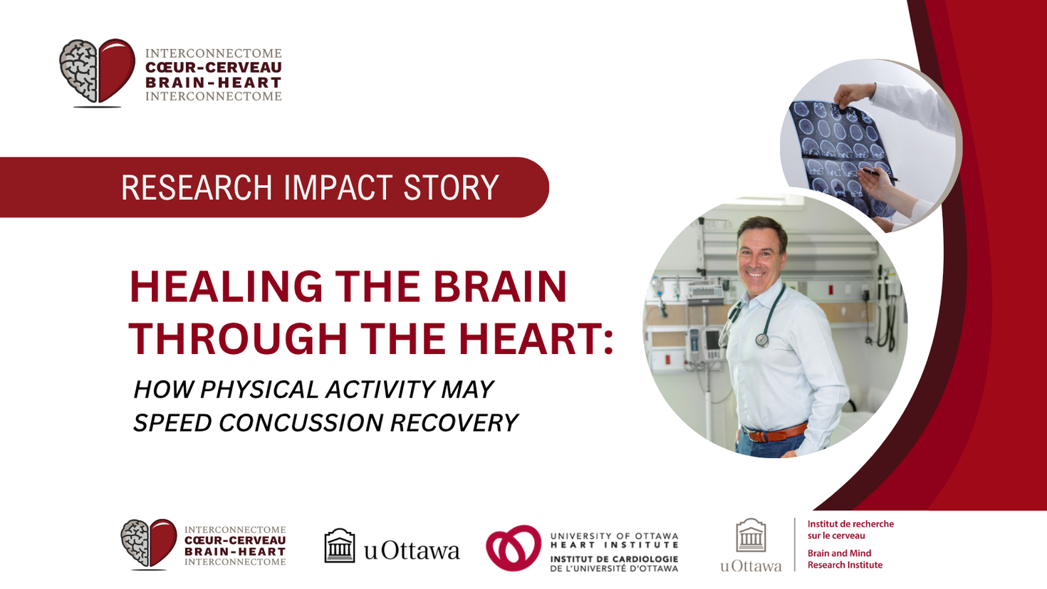 "Research Impact story. Healing the Brain through the Heart: How physical activity may speed concussion recovery."