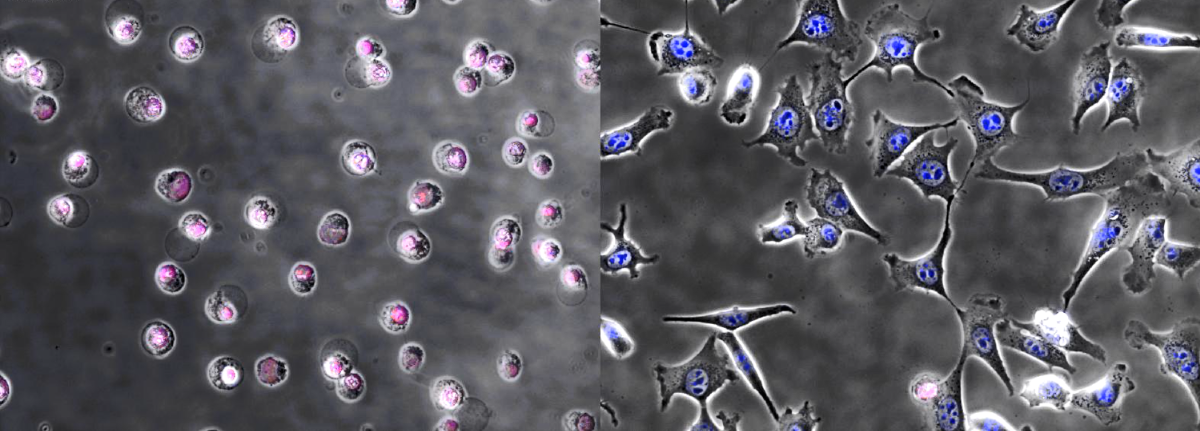 Dead cells on the left, live cells on the right