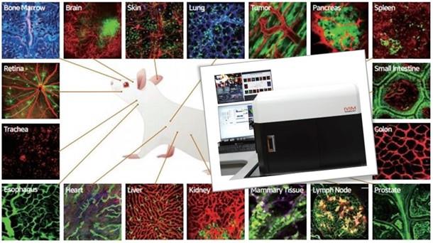 Large gamme de tissus imagés par IVIM. (Technologie IVIM)