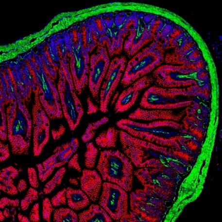 Photo prises dans le CBIA Core
