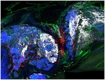 Photo prise dans le cadre de la Core CBIA intitulée When bones collide