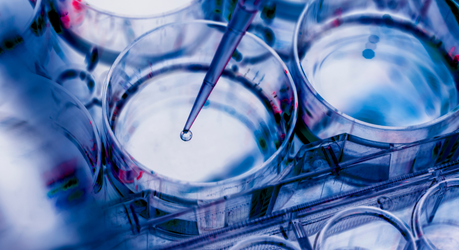 Échantillon de recherche dans un récipient