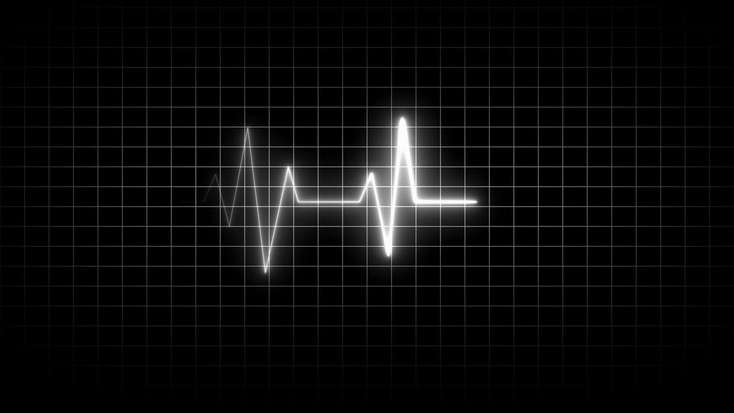 White Neon Heartbeat Line on Dark Grid Background electrocardiogram 